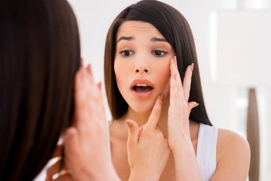 Stop Hiding Your Acne: Why Working with an Acne Specialist Changes Everything