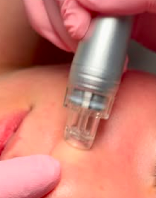 Hydrofacial with Oxygen Treatment: The Ultimate Glow-Up Facial in Gilbert & Mesa, AZ