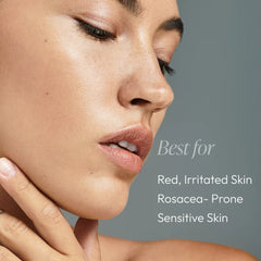 Rose-Ease Relief Cream